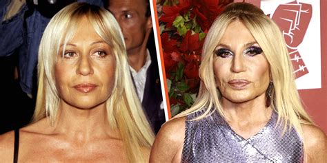 donatella versace before|Donatella Versace without plastic surgery.